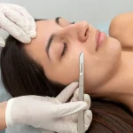 dermaplaning in Houston