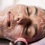 resurfacing facial in Westchase Texas